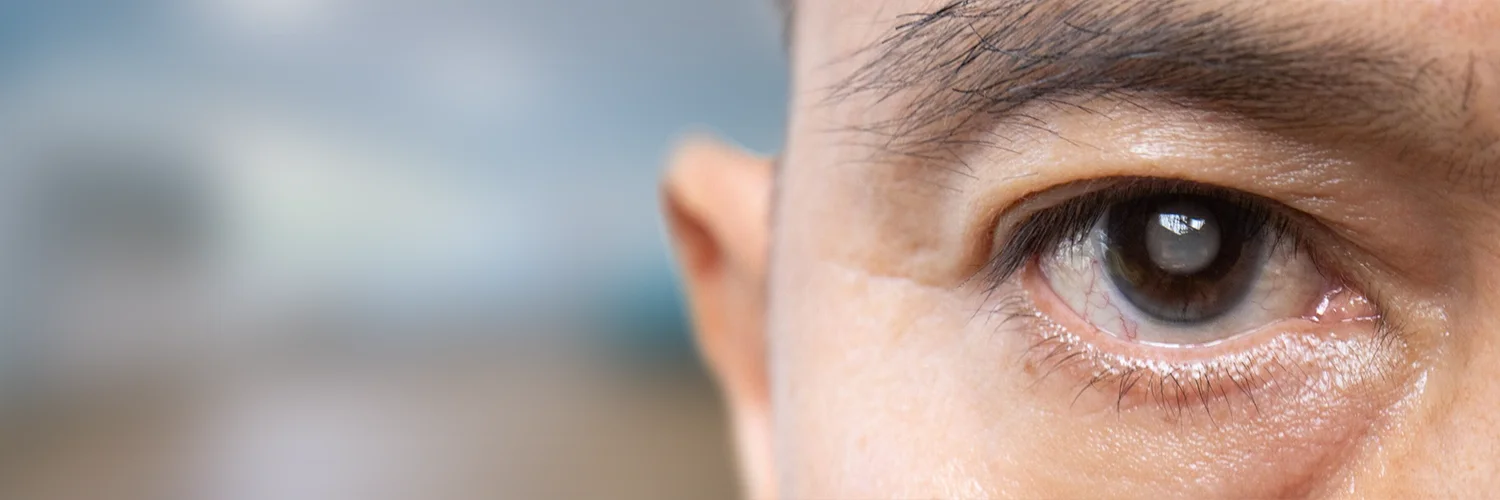 Glaucoma screening and eye pressure check at Sahu Eye Hospital, Mumbai