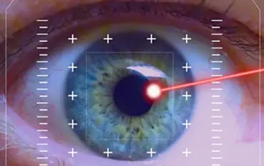 Lasik vision surgery