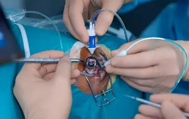 Retinal Diseases